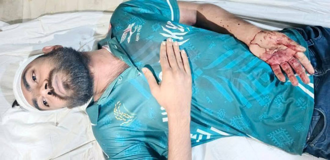 ভেড়ামারায়  গুলিবিদ্ধ হয়ে ২জন আহত