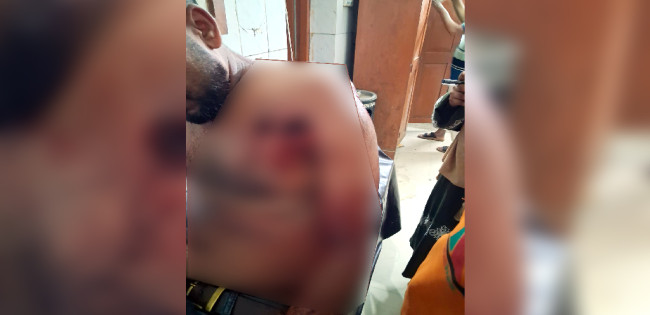 গুলিবিদ্ধ যুবক: গভীর রাতে পদ্মায় স্পিডবোট ট্রায়াল,